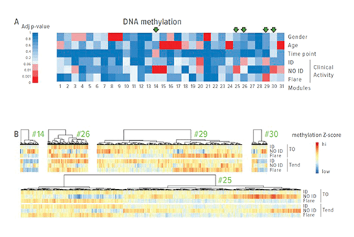 These figures depict results from DNA methylation analysis of CD4+ T cells collected from 68 patients with JIA. Cells were analyzed at the time of treatment withdrawal, at the time of flare, and up to eight months after treatment withdrawal. A: Arrows mark five CpG modules associated with clinical activity, but not with gender or age. B: These figures depict the median z-scored methylation level of each CpG site belonging to the five modules.